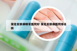 保定皮膚病哪家醫(yī)院好 保定皮膚病醫(yī)院排名榜
