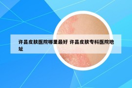 許昌皮膚醫(yī)院哪里最好 許昌皮膚專科醫(yī)院地址