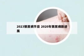 2023銀屑病節(jié)目 2020年銀屑病新進(jìn)展