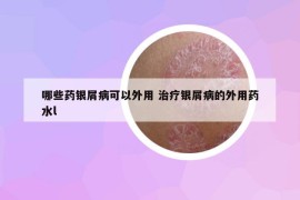 哪些藥銀屑病可以外用 治療銀屑病的外用藥水l