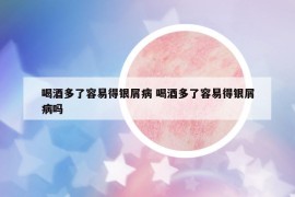 喝酒多了容易得銀屑病 喝酒多了容易得銀屑病嗎