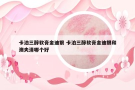 卡泊三醇軟膏金迪銀 卡泊三醇軟膏金迪銀和澳夫清哪個好