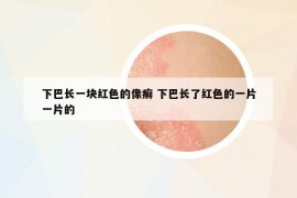 下巴長(zhǎng)一塊紅色的像癬 下巴長(zhǎng)了紅色的一片一片的