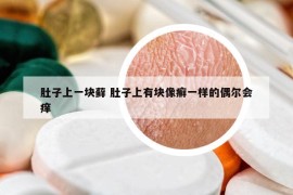 肚子上一塊蘚 肚子上有塊像癬一樣的偶爾會(huì)癢