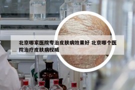 北京哪家醫(yī)院專治皮膚病效果好 北京哪個醫(yī)院治療皮膚病權(quán)威