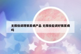 無限極調(diào)理銀屑病產(chǎn)品 無限極能調(diào)好銀屑病嗎