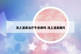 湯上溫泉治療牛皮癬嗎 湯上溫泉圖片