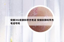 安順302皮膚科李杰電話 安順皮膚科李杰電話號碼