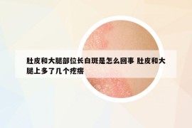 肚皮和大腿部位長白斑是怎么回事 肚皮和大腿上多了幾個疙瘩