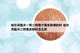 哈爾濱醫(yī)大一和二院哪個看皮膚病的好 哈爾濱醫(yī)大二院看皮膚科怎么樣