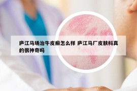 廬江馬場(chǎng)治牛皮癬怎么樣 廬江馬廠皮膚科真的很神奇嗎