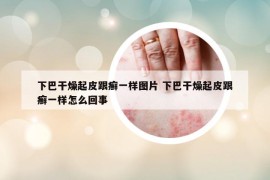 下巴干燥起皮跟癬一樣圖片 下巴干燥起皮跟癬一樣怎么回事