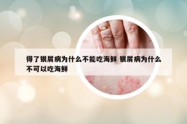 得了銀屑病為什么不能吃海鮮 銀屑病為什么不可以吃海鮮