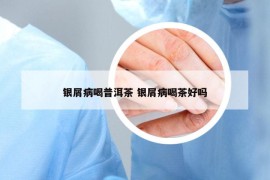 銀屑病喝普洱茶 銀屑病喝茶好嗎