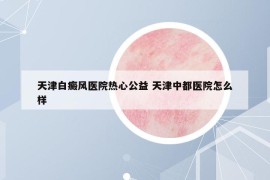 天津白癜風(fēng)醫(yī)院熱心公益 天津中都醫(yī)院怎么樣