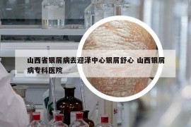 山西省銀屑病去迎澤中心銀屑舒心 山西銀屑病專科醫(yī)院