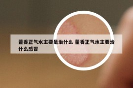 藿香正氣水主要是治什么 藿香正氣水主要治什么感冒