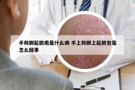 手和腳起膿皰是什么病 手上和腳上起膿包是怎么回事
