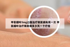 甲氨蝶呤5mg口服治療銀屑病每周一次 甲氨蝶呤治療銀屑病多少天一個(gè)療程