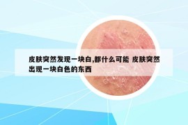 皮膚突然發(fā)現(xiàn)一塊白,都什么可能 皮膚突然出現(xiàn)一塊白色的東西