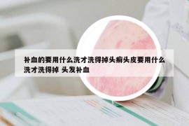 補血的要用什么洗才洗得掉頭癬頭皮要用什么洗才洗得掉 頭發(fā)補血