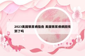 2023美國銀屑病指南 美國銀屑病病因找到了嗎