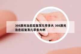 308激光治愈后復(fù)發(fā)幾率多大 308激光治愈后復(fù)發(fā)幾率多大啊