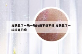 皮膚起了一塊一塊的癬不痛不癢 皮膚起了一塊塊兒的癬