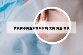 黃芪黃芩黃連大黃銀屑病 大黃 黃連 黃芪