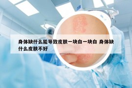 身體缺什么能導(dǎo)致皮膚一塊白一塊白 身體缺什么皮膚不好