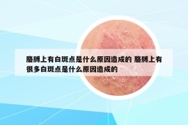 胳膊上有白斑點(diǎn)是什么原因造成的 胳膊上有很多白斑點(diǎn)是什么原因造成的