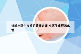 針對小區(qū)牛皮癬的管理方案 小區(qū)牛皮鮮怎么管