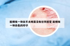 臉頰有一塊白不太明顯沒(méi)有任何感覺(jué) 臉頰有一塊白色的印子