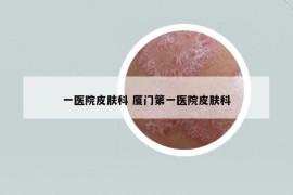 一醫(yī)院皮膚科 廈門第一醫(yī)院皮膚科