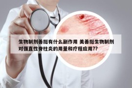 生物制劑善挺有什么副作用 美善挺生物制劑對強直性脊柱炎的用量和療程應用??