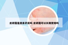 皮研霜是激素藥膏嗎 皮研霜可以長期使用嗎