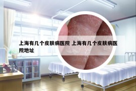 上海有幾個皮膚病醫(yī)院 上海有幾個皮膚病醫(yī)院地址