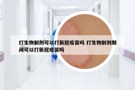 打生物制劑可以打新冠疫苗嗎 打生物制劑期間可以打新冠疫苗嗎