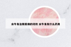 水牛角治銀屑病的功效 水牛角有什么藥用
