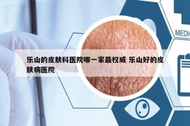 樂山的皮膚科醫(yī)院哪一家最權(quán)威 樂山好的皮膚病醫(yī)院