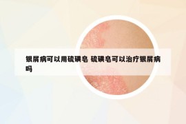 銀屑病可以用硫磺皂 硫磺皂可以治療銀屑病嗎