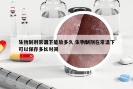 生物制劑常溫下能放多久 生物制劑在常溫下可以保存多長時間
