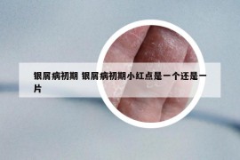 銀屑病初期 銀屑病初期小紅點是一個還是一片