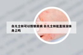 白凡士林可以擦銀屑病 白凡士林能直接涂抹身上嗎