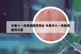 長春八一皮膚病醫(yī)院地址 長春市八一皮膚病醫(yī)院位置