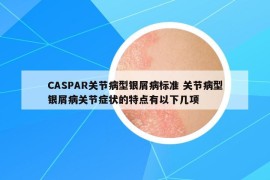 CASPAR關(guān)節(jié)病型銀屑病標(biāo)準(zhǔn) 關(guān)節(jié)病型銀屑病關(guān)節(jié)癥狀的特點(diǎn)有以下幾項(xiàng)
