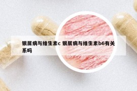 銀屑病與維生素c 銀屑病與維生素b6有關(guān)系嗎