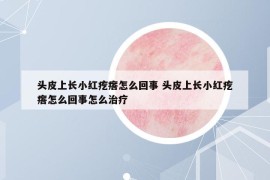 頭皮上長(zhǎng)小紅疙瘩怎么回事 頭皮上長(zhǎng)小紅疙瘩怎么回事怎么治療