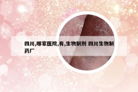 四川,哪家醫(yī)院,有,生物制劑 四川生物制藥廠