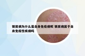銀屑病為什么是自身免疫病呢 銀屑病屬于自身免疫性疾病嗎